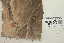  Bastas de la pierna izquierda (Sup.).png